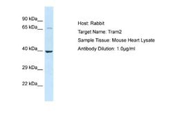TRAM2 Antibody, Novus Biologicals 100 &mu;L; Unconjugated:Antibodies, Polyclonal
